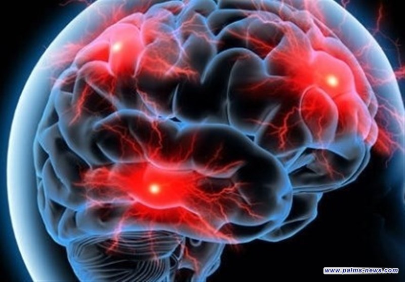 إيران تنجح بإنتاج دواء إشعاعي يكشفُ مرض الزهايمر قبل 20 عاماً من ظهوره